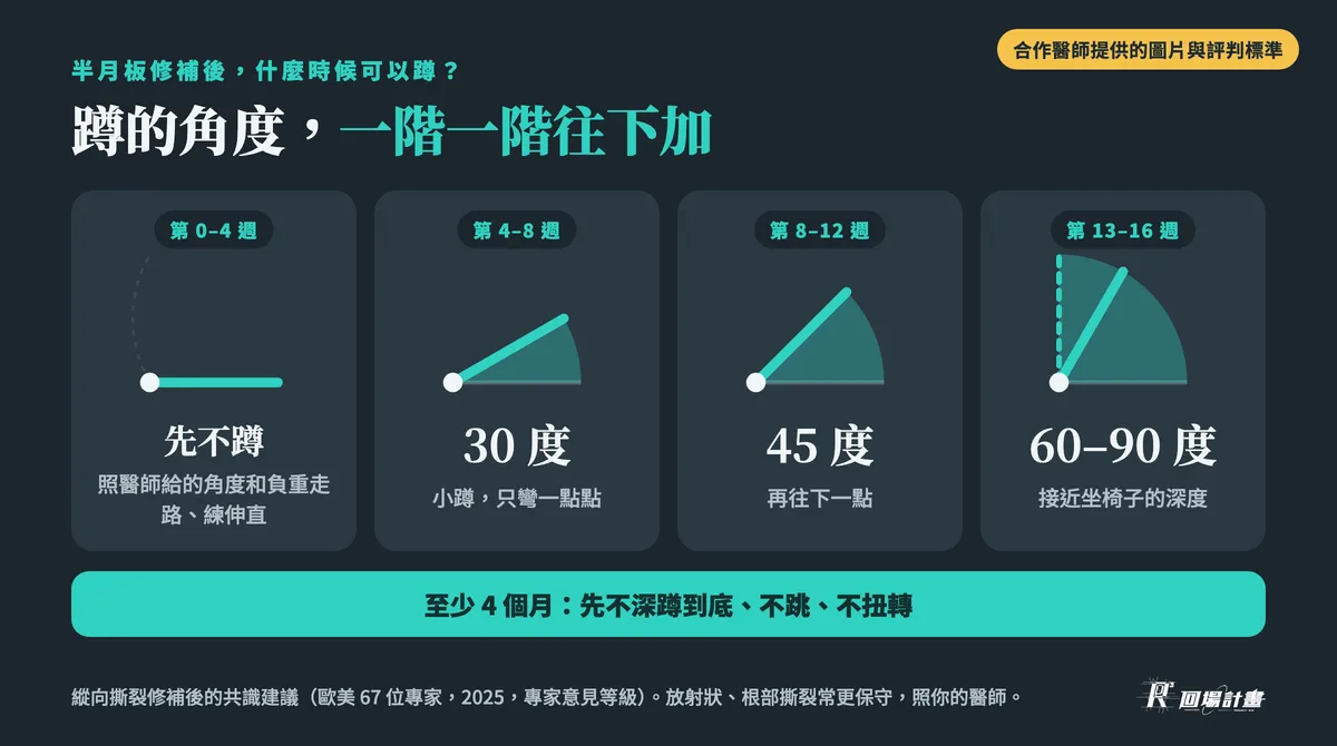 半月板修補後什麼時候可以蹲:第 4–8 週小蹲 30 度、第 8–12 週 45 度、第 13–16 週 60–90 度,至少 4 個月不深蹲到底、不跳、不扭轉