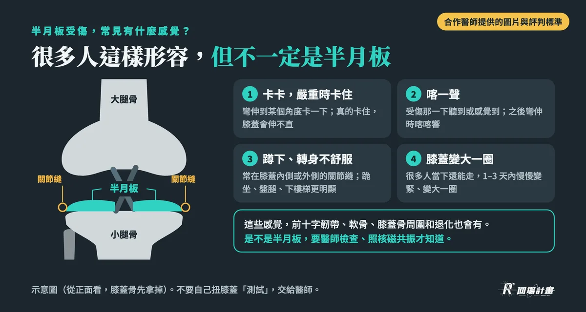 半月板受傷症狀:常見的 4 種感覺,卡卡或卡住、喀一聲、蹲下轉身時關節縫不舒服、膝蓋變大一圈;這些感覺別的狀況也會有,是不是半月板要醫師檢查確認