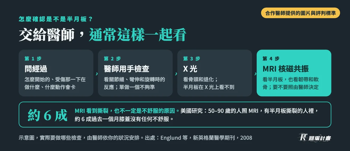 怎麼確認是不是半月板損傷:醫師問經過、用手檢查、X 光看骨頭和退化、MRI 核磁共振看半月板;MRI 看到撕裂不一定是不舒服的原因