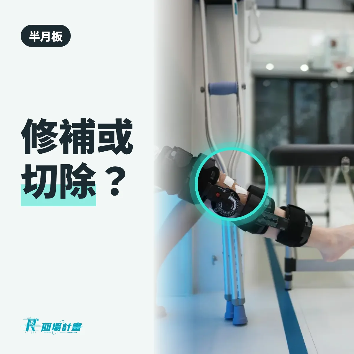 半月板修補和切除差在哪?前期快慢、長期都不一樣