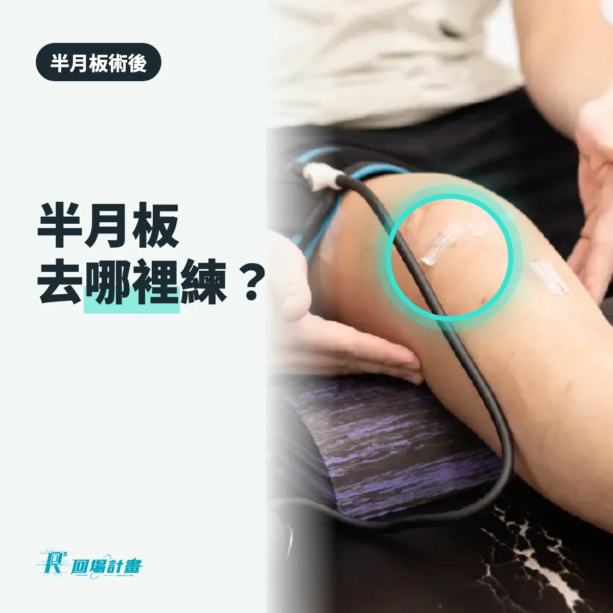 半月板術後要去哪裡練?醫院、診所、肌力訓練團隊,各適合哪個階段
